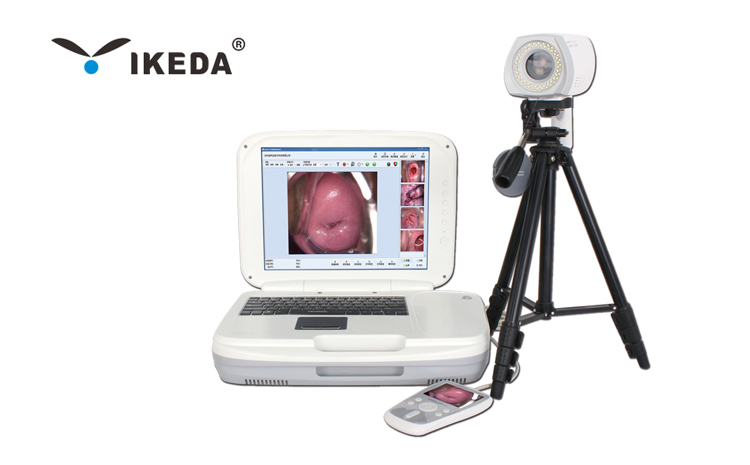 數(shù)碼電子陰道鏡常見的故障及原因 數(shù)碼電子陰道鏡常見的故障及原因