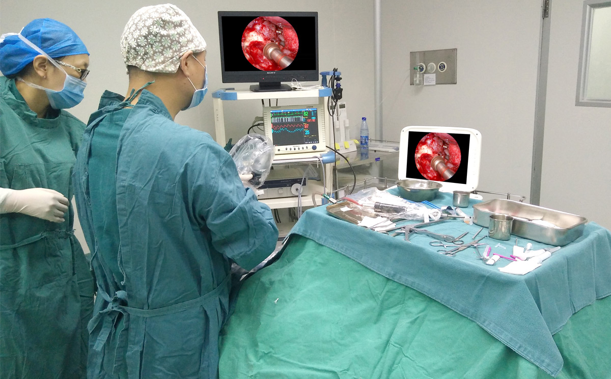 內(nèi)窺鏡攝像機的工作原理 內(nèi)窺鏡攝像機的工作原理