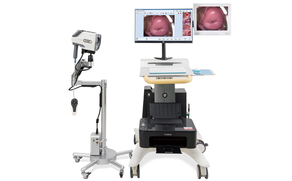 如何選擇數(shù)碼電子陰道鏡？