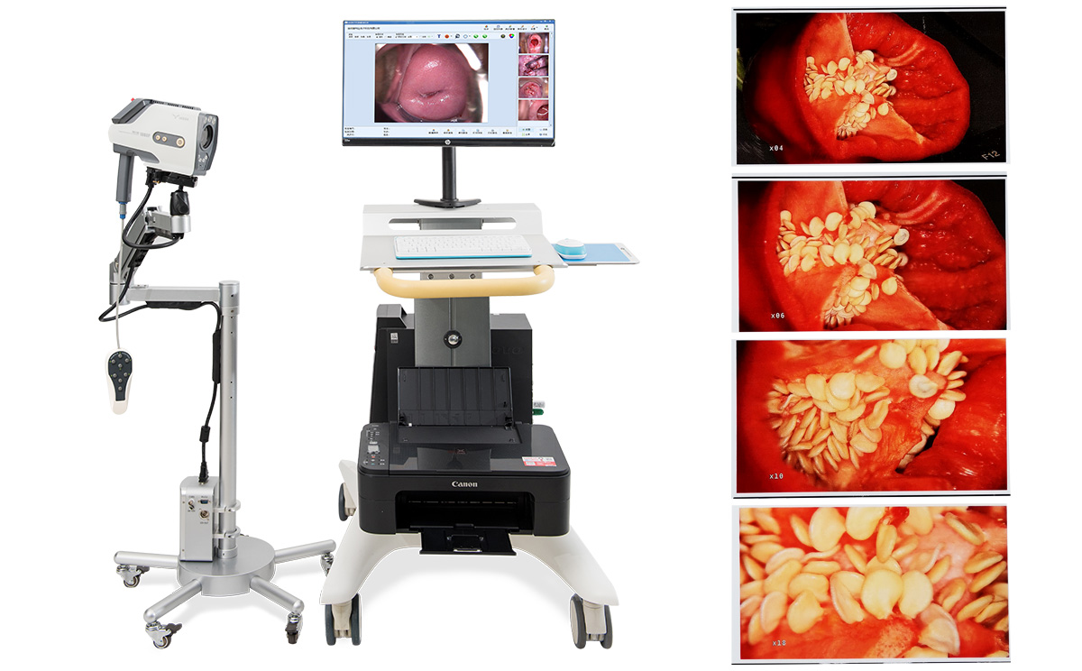 電子陰道鏡工作站的特點(diǎn) 電子陰道鏡工作站的特點(diǎn)