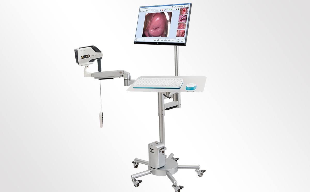 陰道鏡廠家：哪里可以買到陰道鏡？陰道鏡價格？
