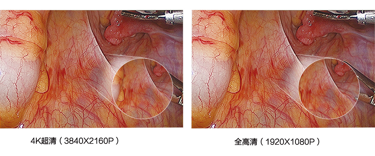 益柯達(dá)4K超高清內(nèi)窺鏡攝像系統(tǒng) 益柯達(dá)4K超高清內(nèi)窺鏡攝像系統(tǒng)