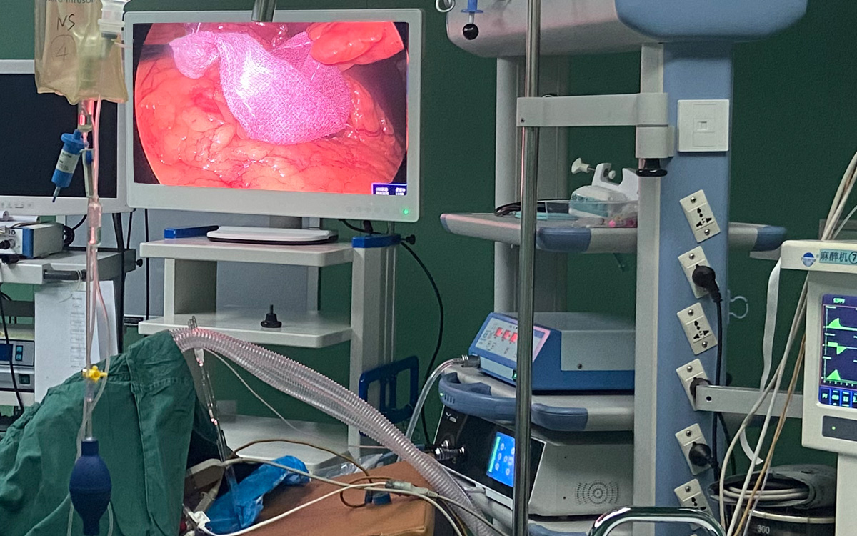 益柯達(dá)4K超高清內(nèi)窺鏡攝像機(jī)臨床手術(shù)應(yīng)用 益柯達(dá)4K超高清內(nèi)窺鏡攝像機(jī)臨床手術(shù)應(yīng)用