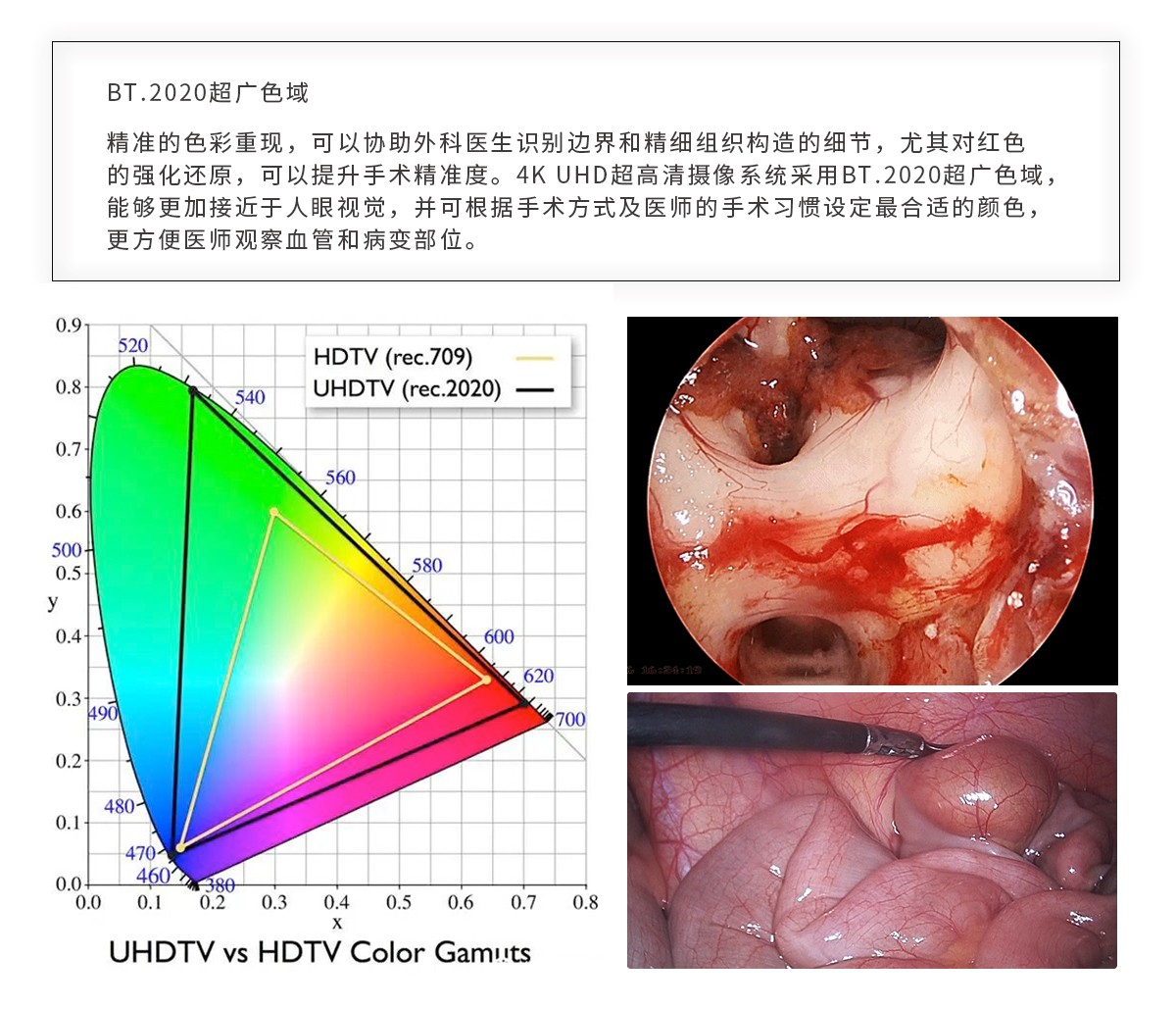 【4K醫(yī)用內(nèi)窺鏡攝像系統(tǒng)】您的第一臺(tái)“4K”找到了嗎？