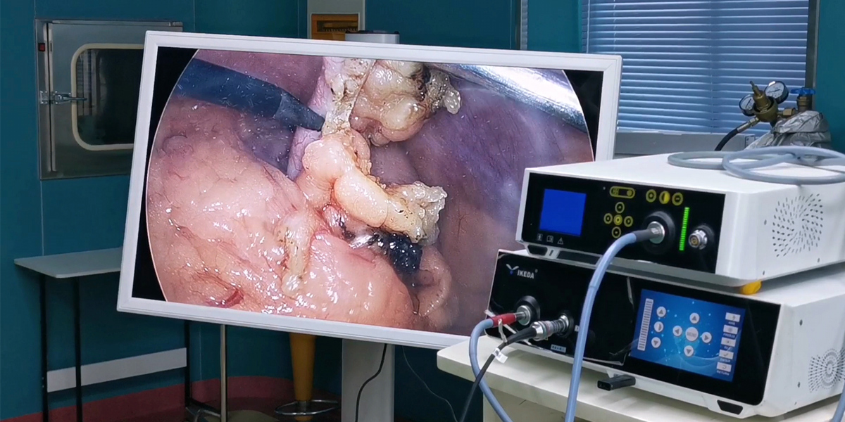 【4K醫(yī)用內(nèi)窺鏡攝像系統(tǒng)】您的第一臺(tái)“4K”找到了嗎？