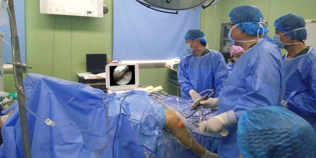 關(guān)節(jié)鏡下松解術(shù)治療膝關(guān)節(jié)粘連 關(guān)節(jié)鏡下松解術(shù)治療膝關(guān)節(jié)粘連