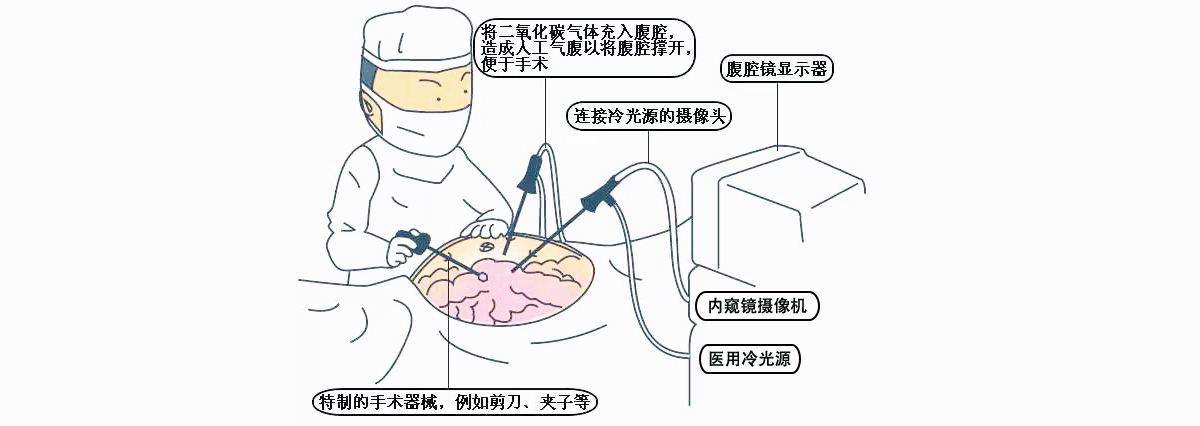 腹腔鏡攝像機使用步驟及注意事項 腹腔鏡攝像機使用步驟及注意事項