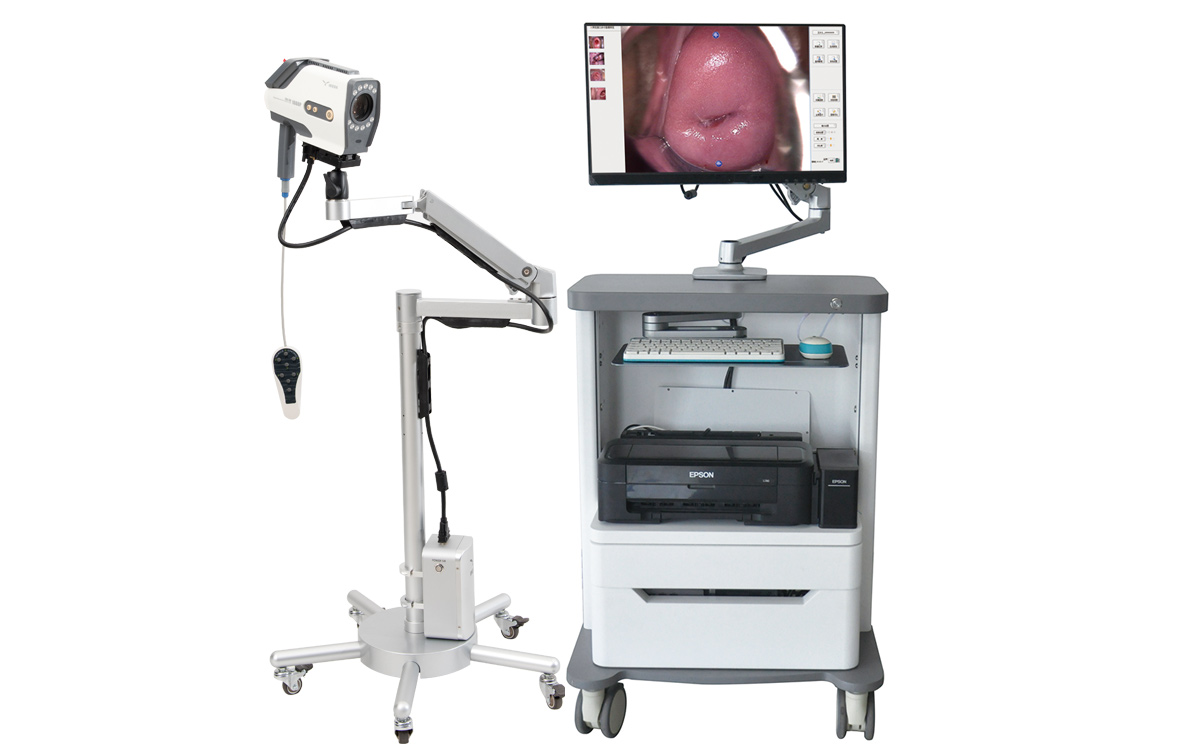 益柯達(dá)新款數(shù)碼電子陰道鏡 益柯達(dá)新款數(shù)碼電子陰道鏡