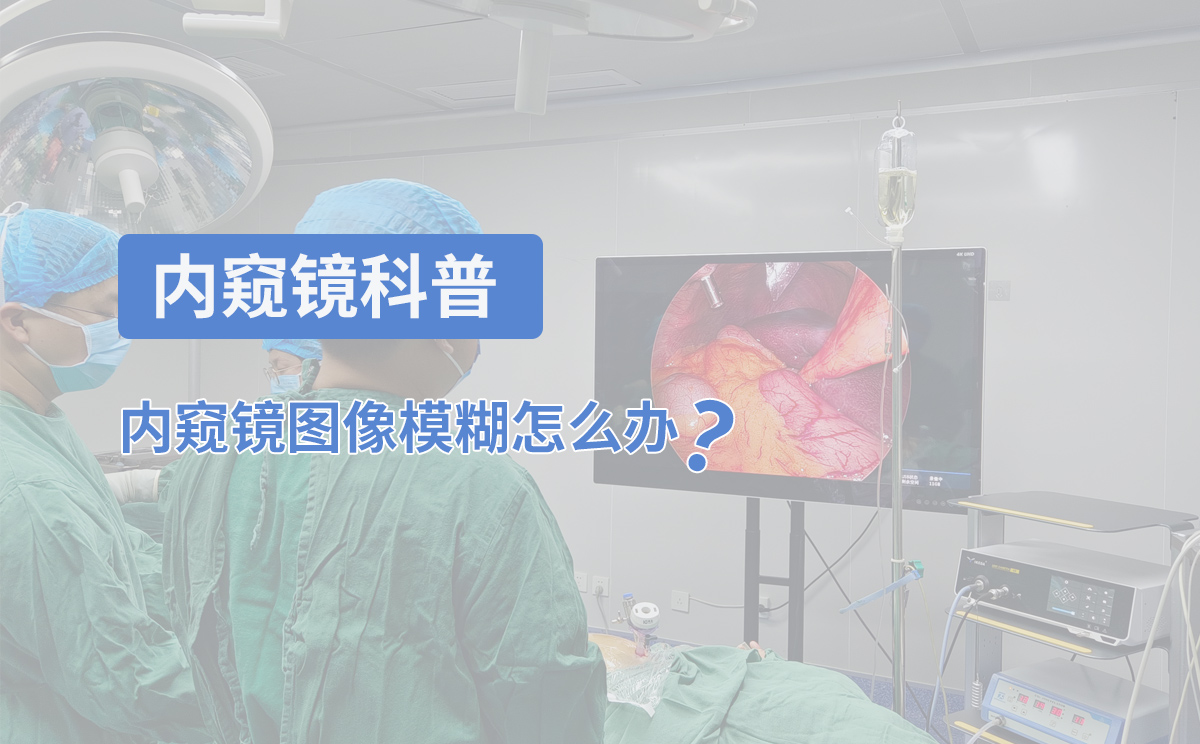 內(nèi)窺鏡科普：內(nèi)窺鏡圖像模糊怎么辦？