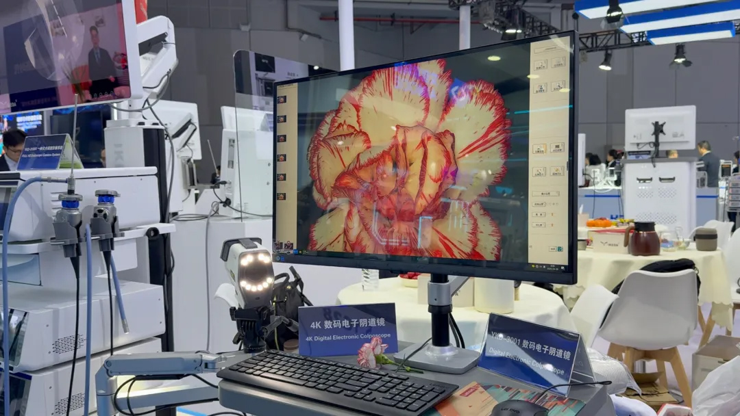 4K數(shù)碼電子陰道鏡