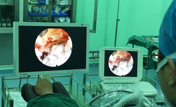 如何維護保養(yǎng)內(nèi)窺鏡顯示器？