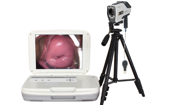 便攜式電子陰道鏡的特點(diǎn)