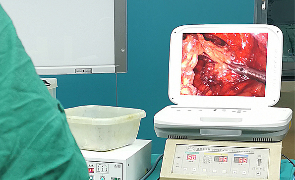 內(nèi)窺鏡攝像機(jī)哪個(gè)好？