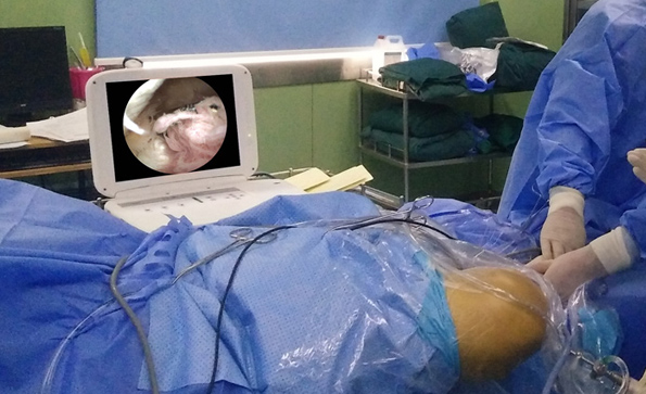 如何保養(yǎng)維護(hù)關(guān)節(jié)鏡？