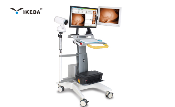 紅外乳腺檢查儀是什么？