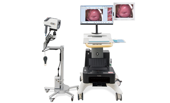 陰道鏡：什么是陰道鏡檢查？什么是活檢?