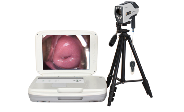 電子陰道鏡檢查都要取活檢嗎？