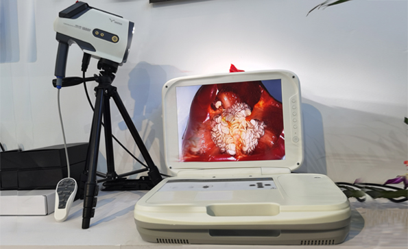 數(shù)碼電子陰道鏡怎么樣？數(shù)碼電子陰道鏡準嗎？