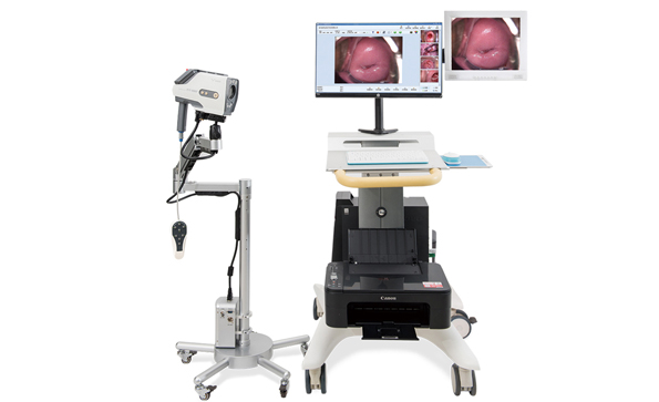 數(shù)碼電子陰道鏡檢查所用的輔助器械和藥品有哪些？