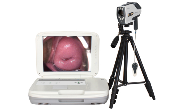 陰道鏡廠家：什么情況下要做陰道鏡？需要注意哪些？