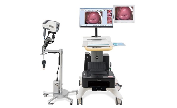 重視陰道鏡檢查的原因是什么？