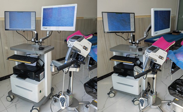 益柯達數(shù)碼電子陰道鏡（雙屏）裝機